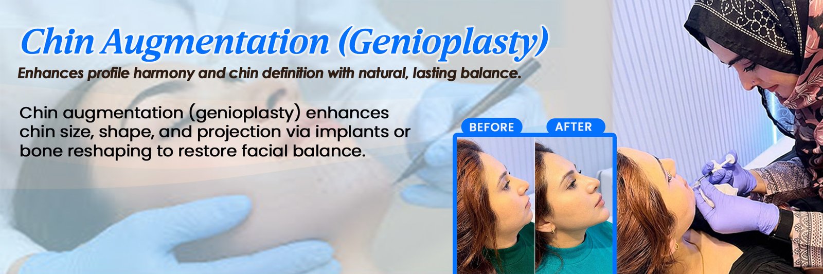 Chin Augmentation (Genioplasty)