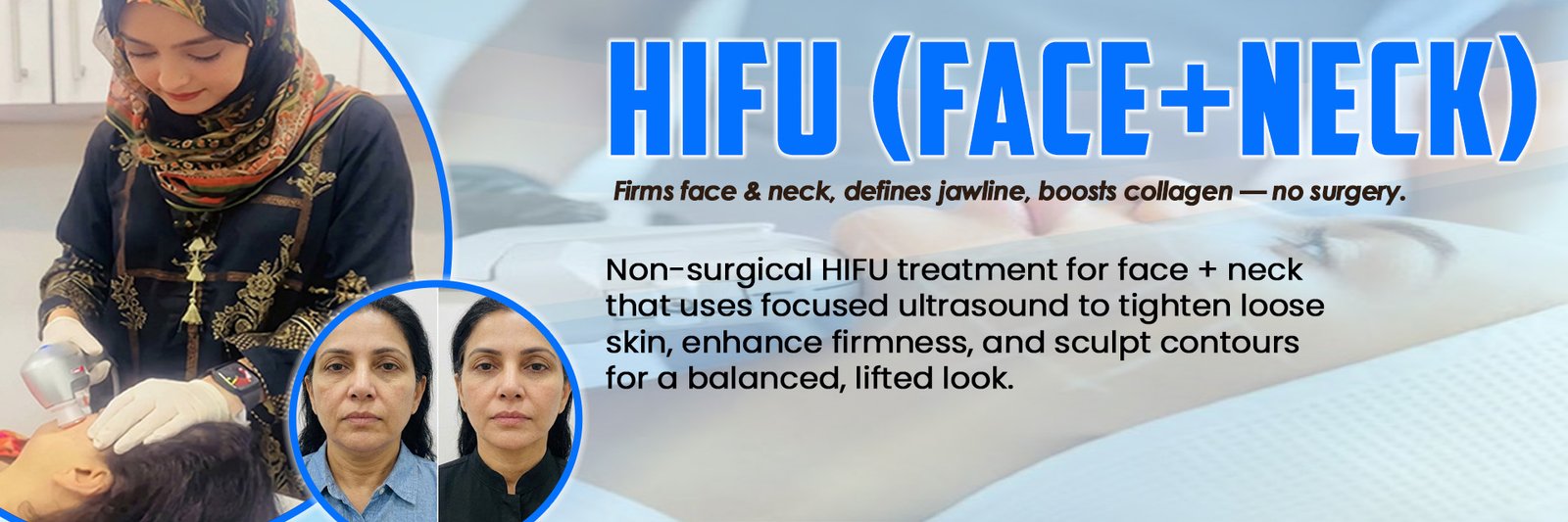 HIFU (Face + Neck)
