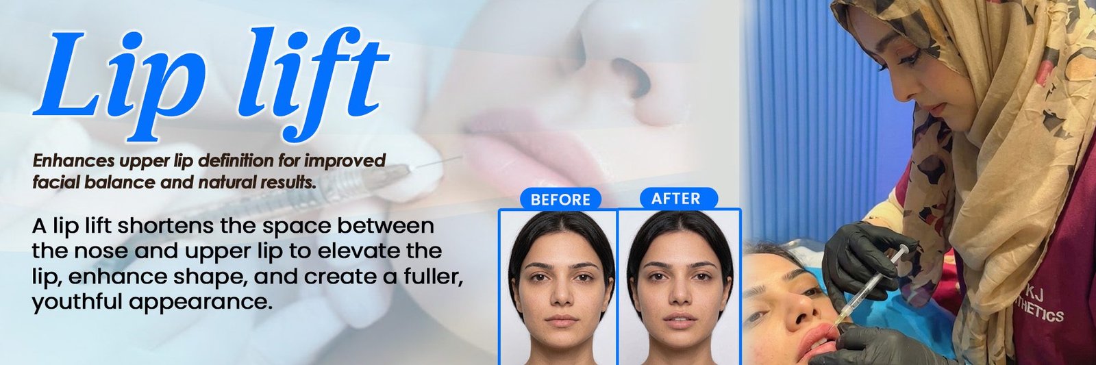 Lip lift