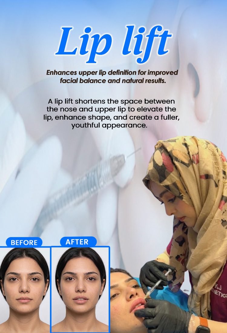 Lip lift