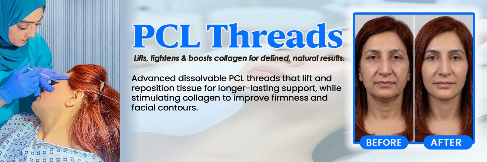 PCL Threads