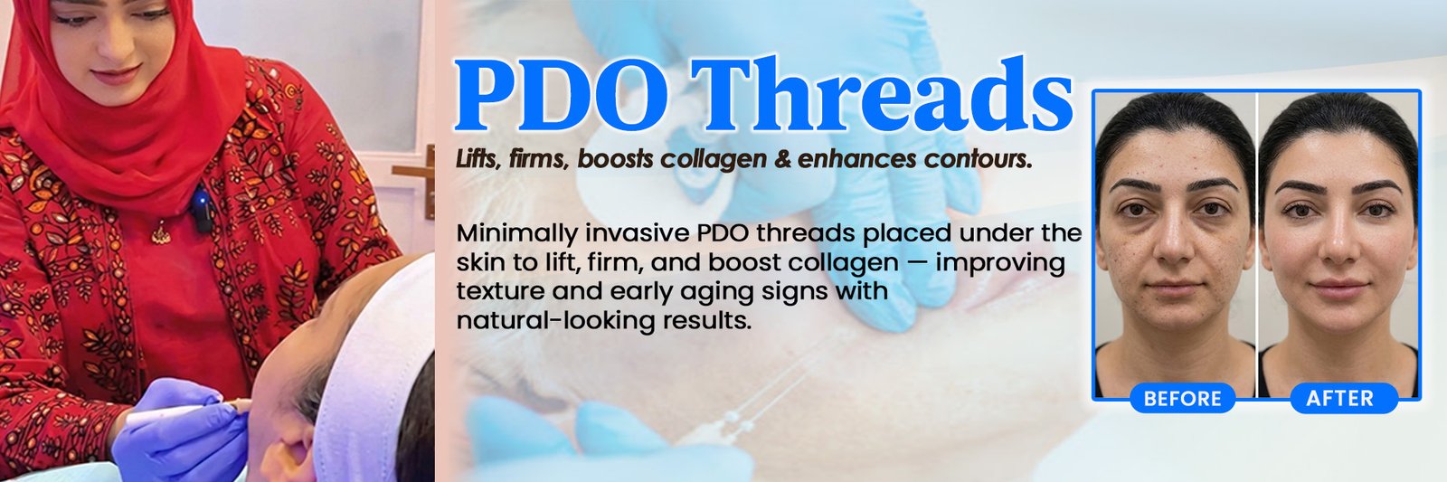 PDO Threads