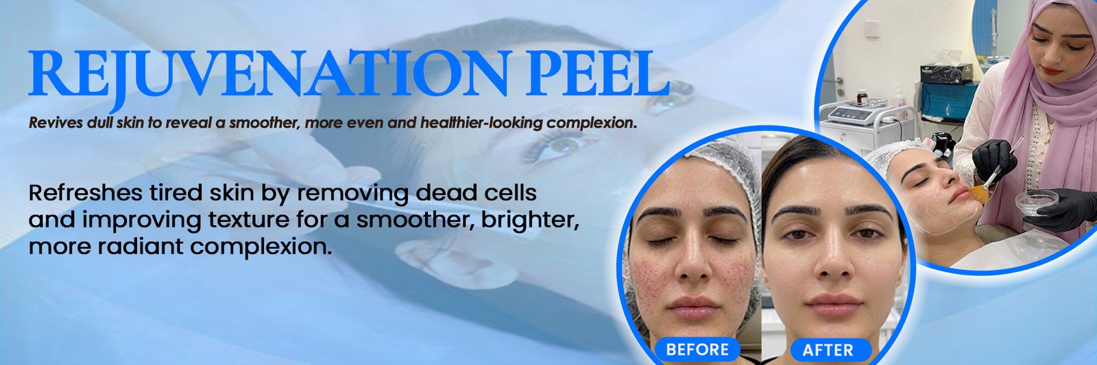 Rejuvenation Peel