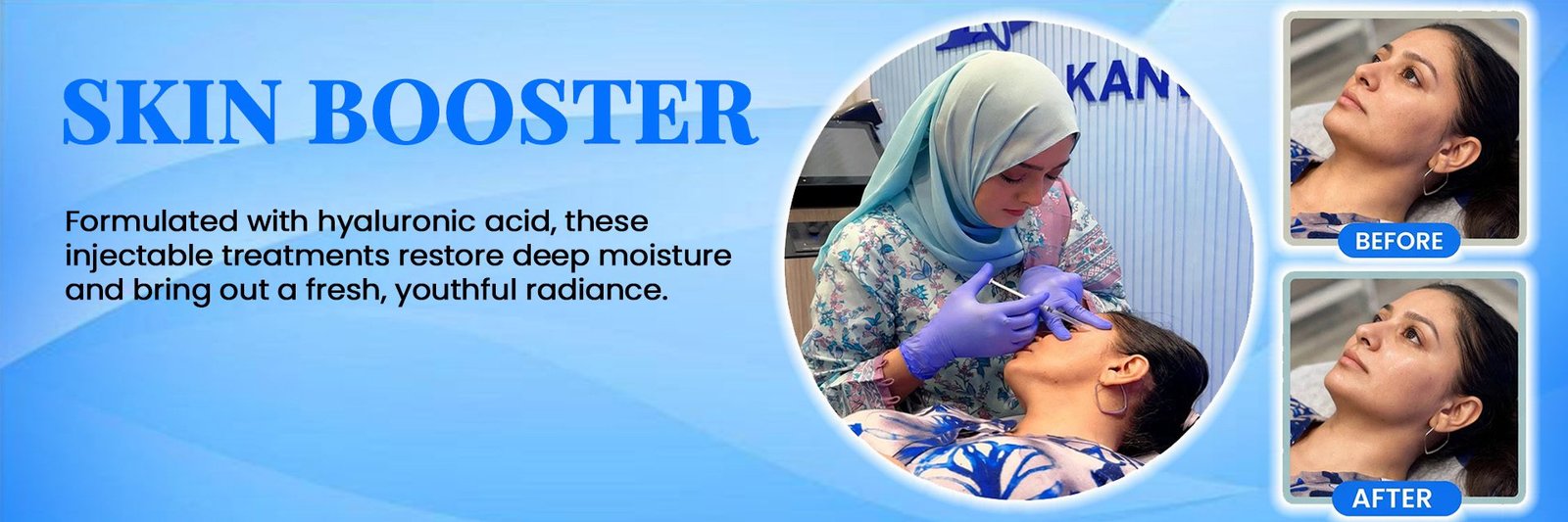 Skin Booster