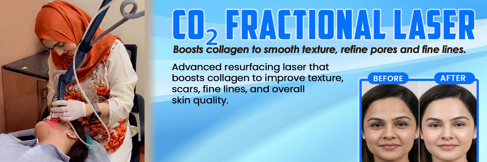 CO2 Fractional Laser