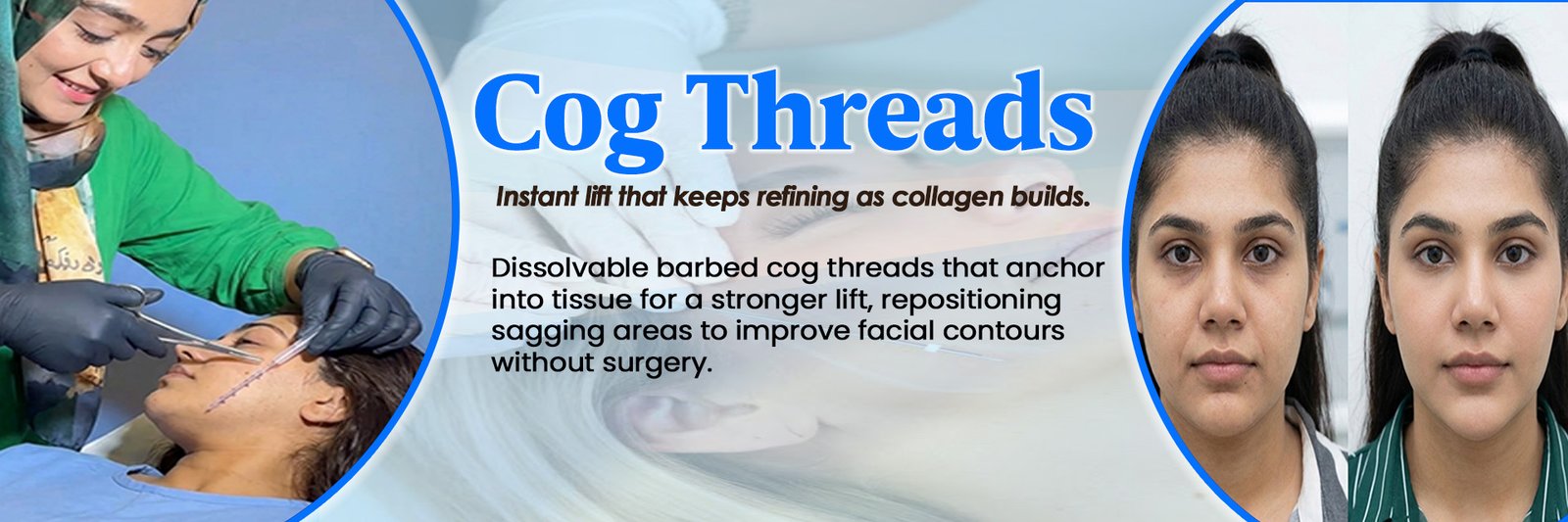 Cog Threads