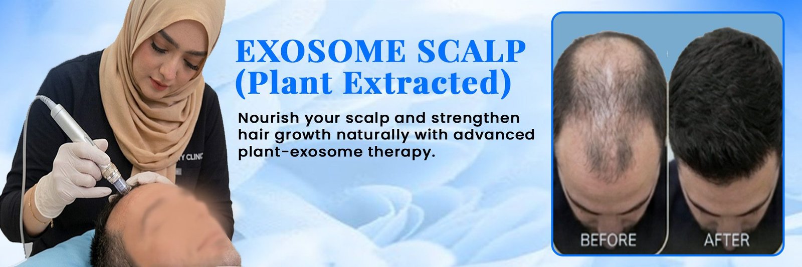 Exosome Scalp (Plant Extracted)